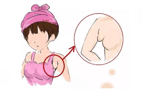 副乳吸脂多少钱手术价格是多少