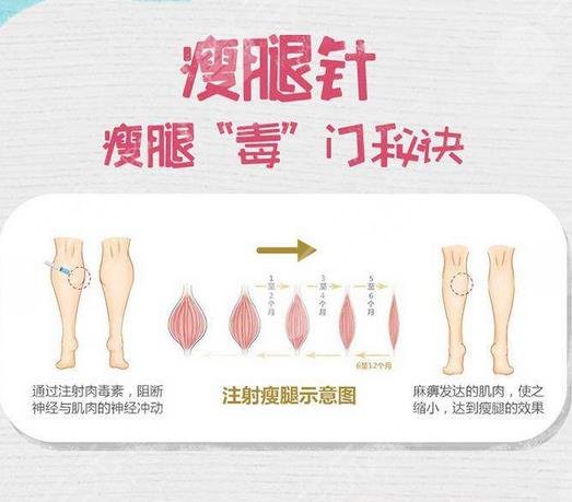 注射瘦腿有用吗?