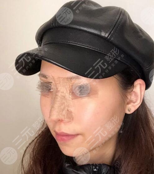 术后恢复期