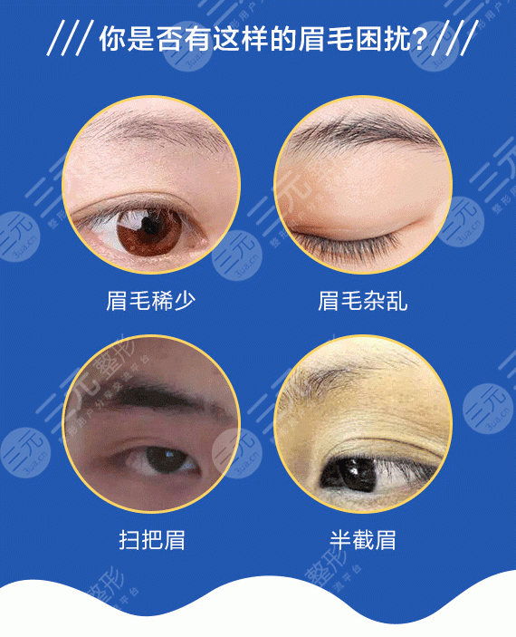 种植眉毛
