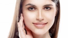 光子嫩肤去痘印、痘坑的果好不好？多少钱？科普答疑来咯~