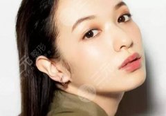 玻尿酸丰太阳穴会不会有危险？成好吗？多少钱？科普大全来了！
