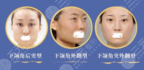 适合人群
