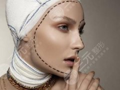 改脸型多少钱？费用参考+术前4大须知问题，必看！