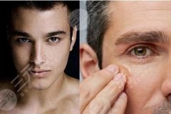 抽脂去眼袋手术需要多长时间？有人做过吗？