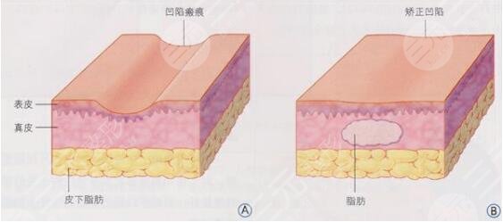 填充原理