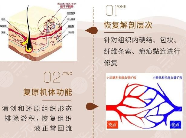 修复能解决什么问题