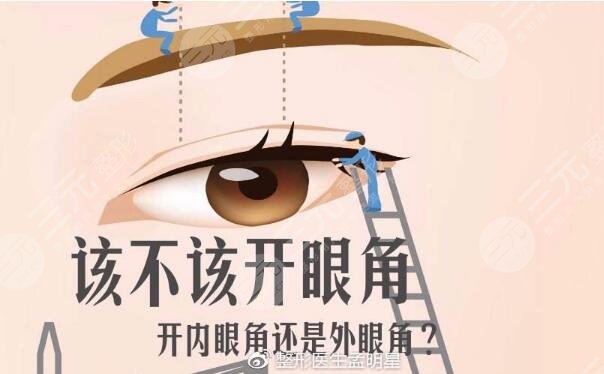 要不要开眼角?先看看你适不适合!