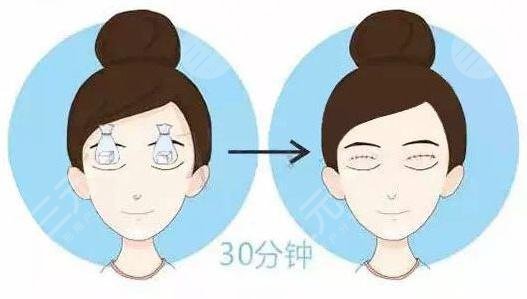术后常见问题