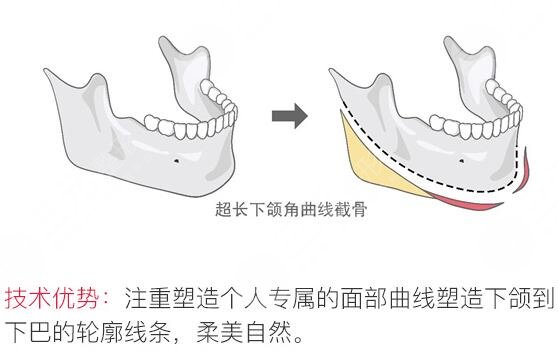 手术简介