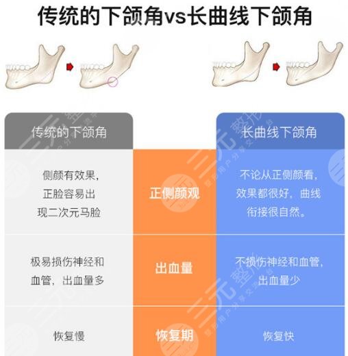 手术区别