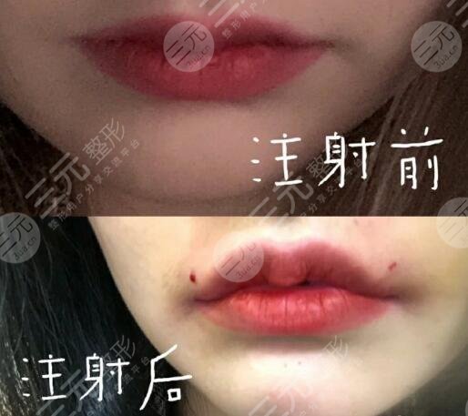 丰唇果