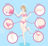 酷塑冷冻减脂的原理是怎样的？减脂的成好吗？