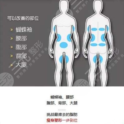 酷塑冷冻减脂的优势