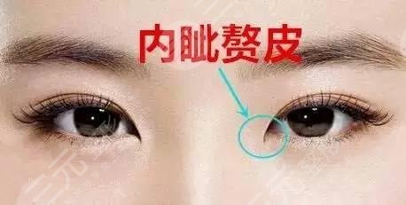 开眼角几天可以拆线