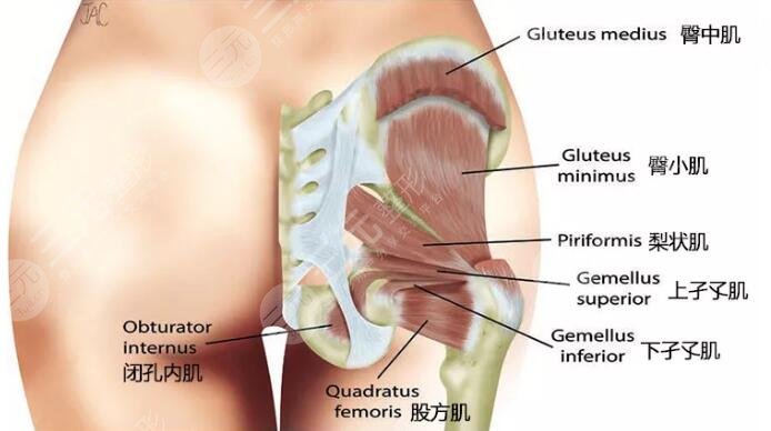 吸脂提臀术的三大优势