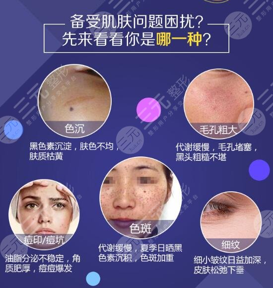 复合彩光嫩肤的作用