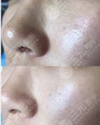 黑脸娃娃对比照片，主要能解决哪些问题？