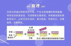 白瓷娃娃激光是什么？原理|作用|频次