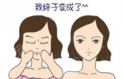 磨颧骨手术大概多少钱？手术原理+术前术后注意事项全科普！