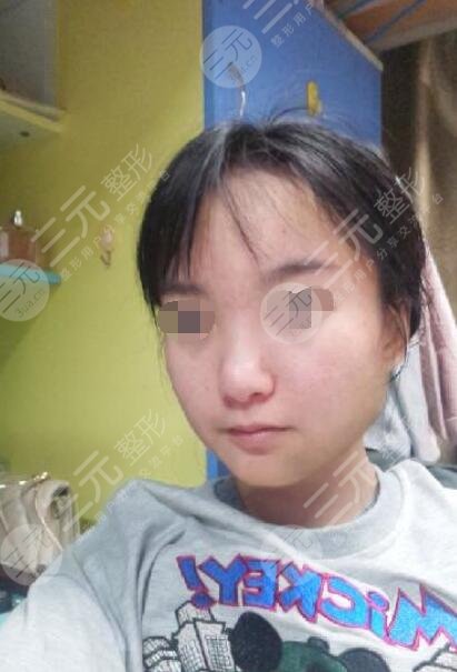 卢丙仑医生的案例前