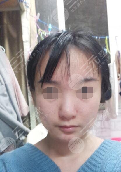 卢丙仑医生的案例前