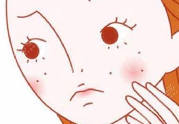 上海激光点斑