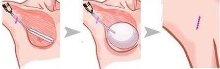 选用的医院医院门诊的影响