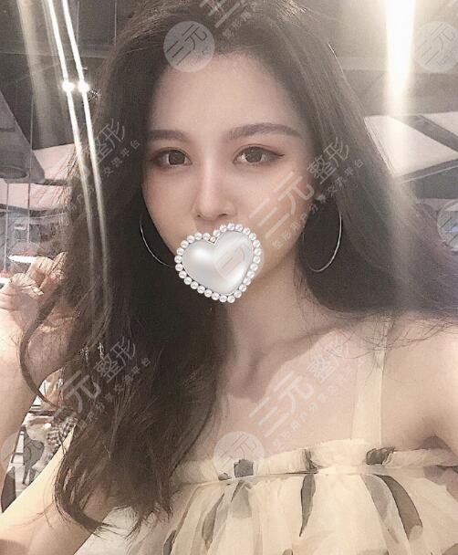 耳软骨隆鼻消肿过程图