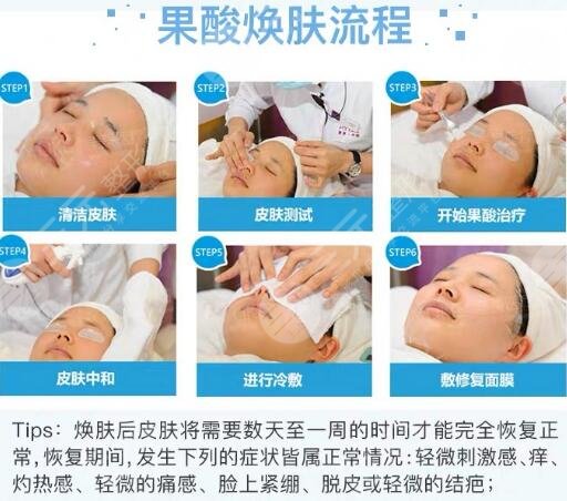 做几次见 果酸原理