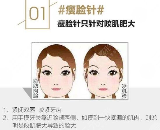 注射瘦脸原理讲解