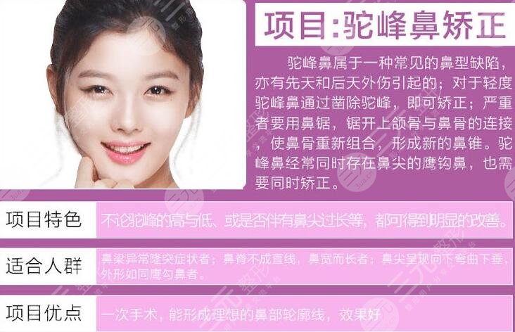 驼峰鼻矫正方法