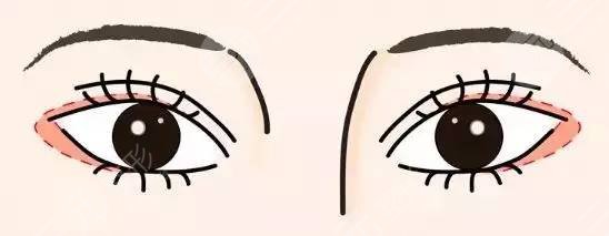 开眼尾和开眼角区别