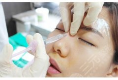 玻尿酸隆鼻果怎么样？图片前后对比|维持多久？