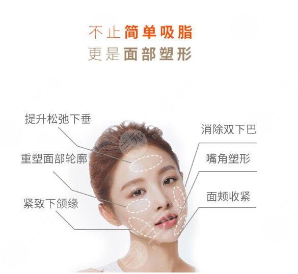 术后需要注意事项