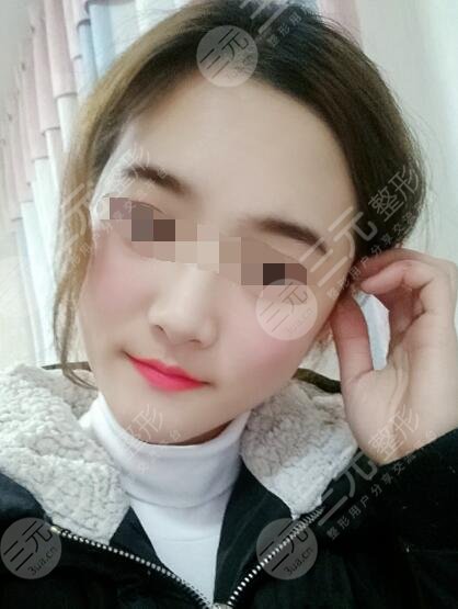 火凤凰溶脂真实果后