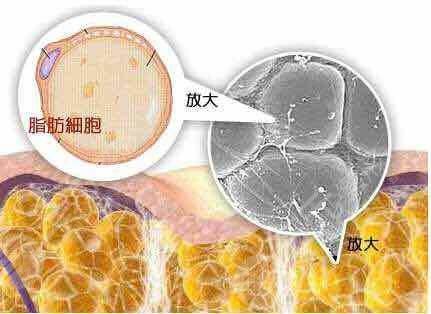 溶脂原理