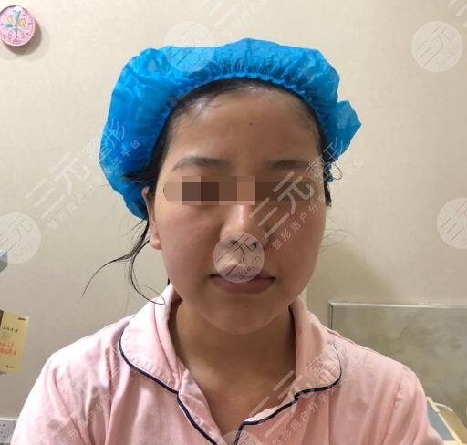 Fotona 4D真人体验前
