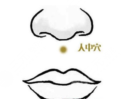 人中延长术前后对比