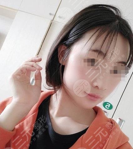 山大二院美容整形外科脸部下颌骨果图