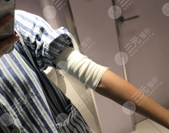 手术后1周
