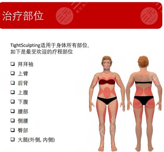 火凤凰溶脂不用恢复期吗