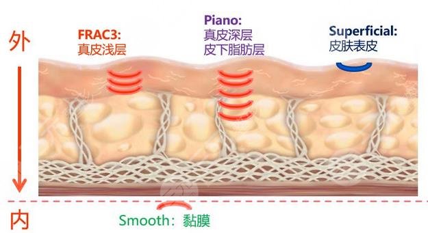 火凤凰溶脂要慎用药物