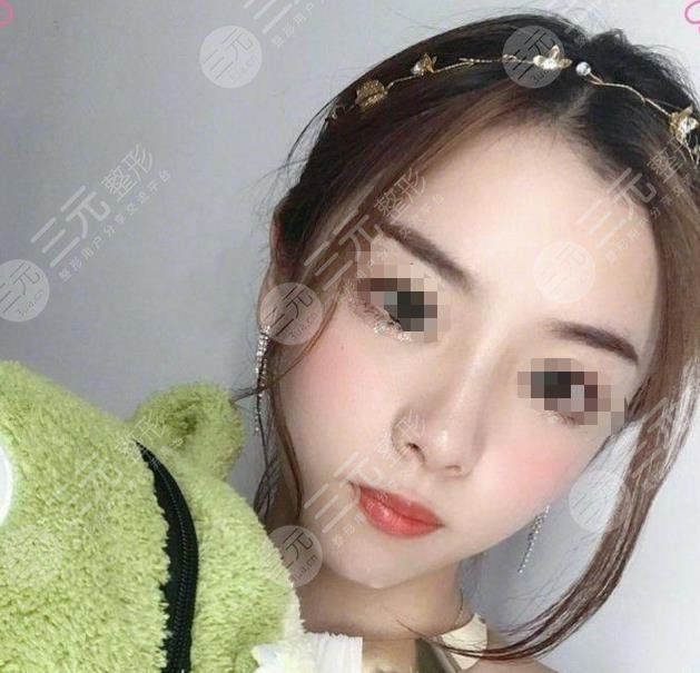 刘彦军做鼻子为什么这么贵真实案例分享美鼻立即拥有