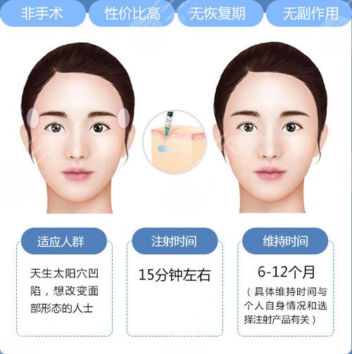 太阳穴填充果怎么样？看一下太阳填充手术后的风险果图