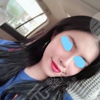 为什么腰腹吸脂后腰会变粗呢?腰腹吸脂恢复过程图来喽!