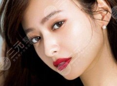 脸部可以做火凤凰溶脂吗？双下巴星人有救了，速来！