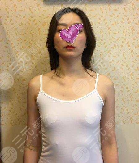 林沸腾医生隆胸图片