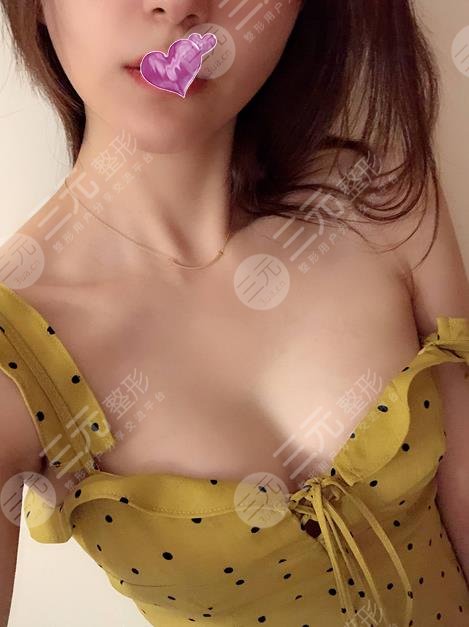 林沸腾医生隆胸图片