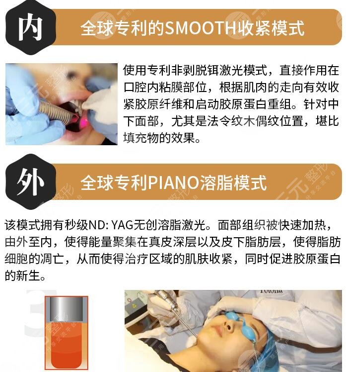 德国fotona特点